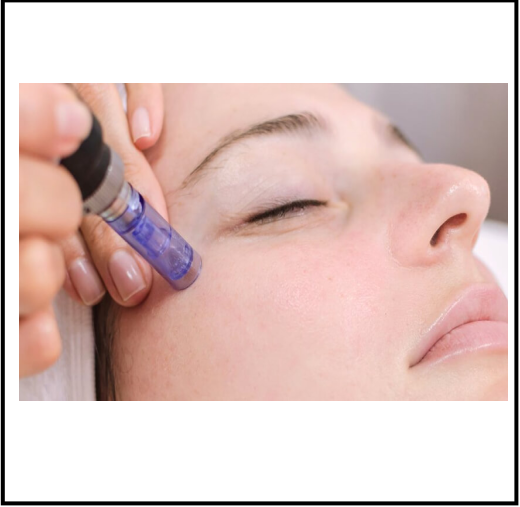 DERMAPEN TEDAVİSİ